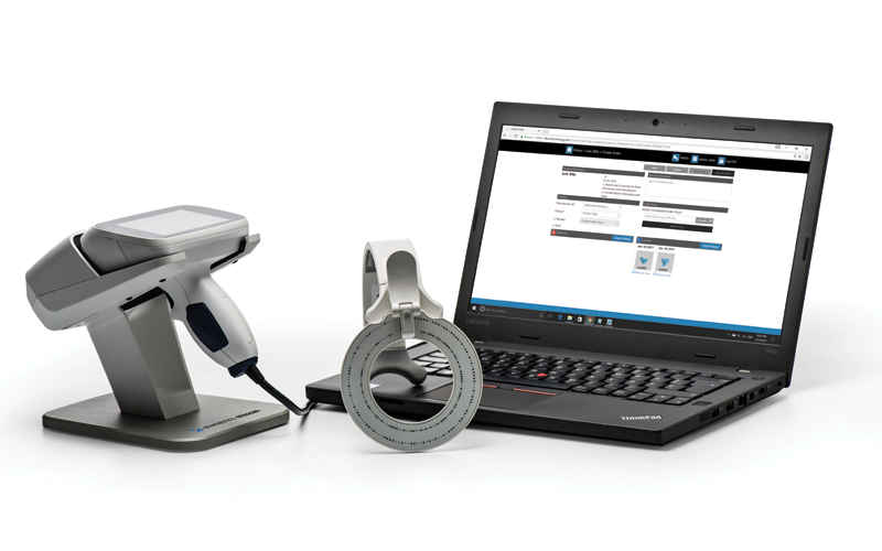 otoscan2